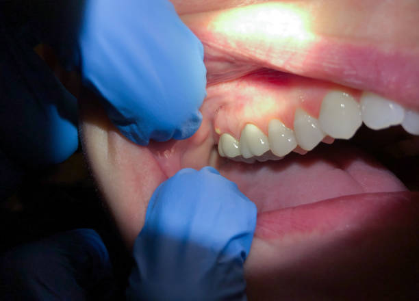 Best Orthodontic Emergency Dentist in Bridgewater Center, NJ